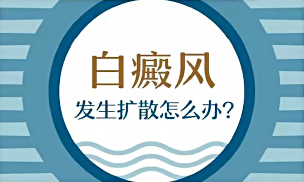 家长不仅仅要关注孩子白癜风的治疗情况